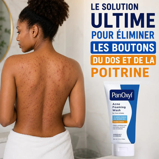 PanOxyl Nettoyant moussant contre l'acné, Peroxyde de benzoyle 10 %