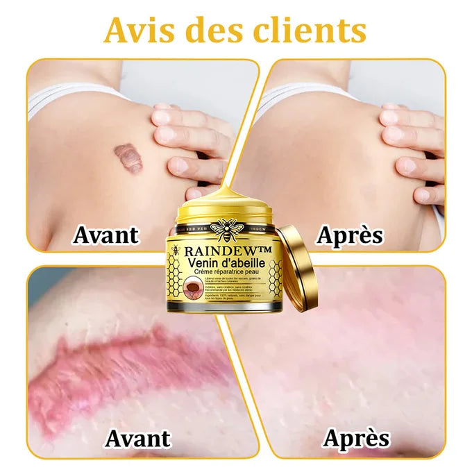 Crème VeninPure™